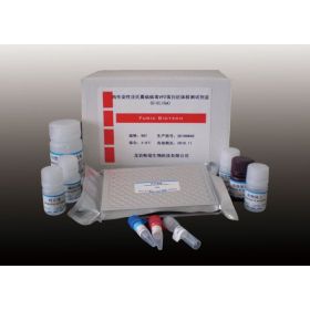 氨基己糖苷酶Bβ(HEXβ)检测试剂盒