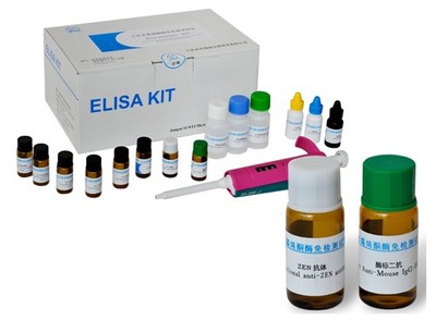 人特异性巨噬细胞武装因子(SMAF)ELISA试剂盒,酶联免疫吸附试剂盒