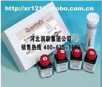 【甘肃庆阳试剂盒crp试剂盒质量最好】2014款,价格,厂家,图片,供应商,其他行业专用机械及设备,邢台润联机械设备 - 产品库 - 阿土伯交易网