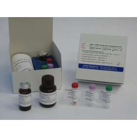 唾液酸转移酶4B(SIAT4B)ELISA试剂盒